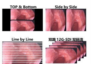 精准影像立体呈现海信4K3D内窥显示器革新医疗显示体验(图3)