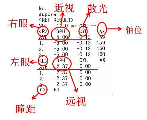星空体育网站：别让暑假成为孩子近视的加速器！正确配镜攻略在此！(图3)