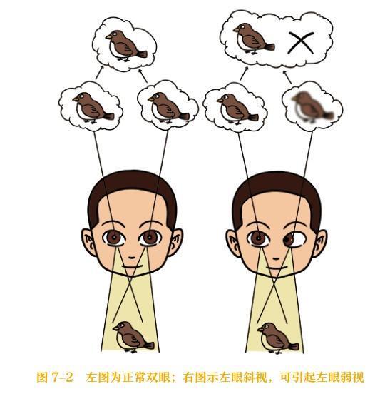 警惕！孩子这种眼睛问题很多家长都忽视了(图2)