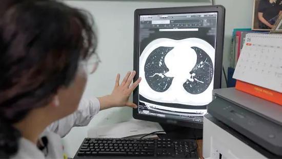 一张影像六市共享一份报告六市互认大连中山推动医疗同质化(图7)